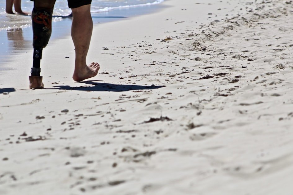 Joint Health Prevent Arthritis Mobility: Complete Health Guide